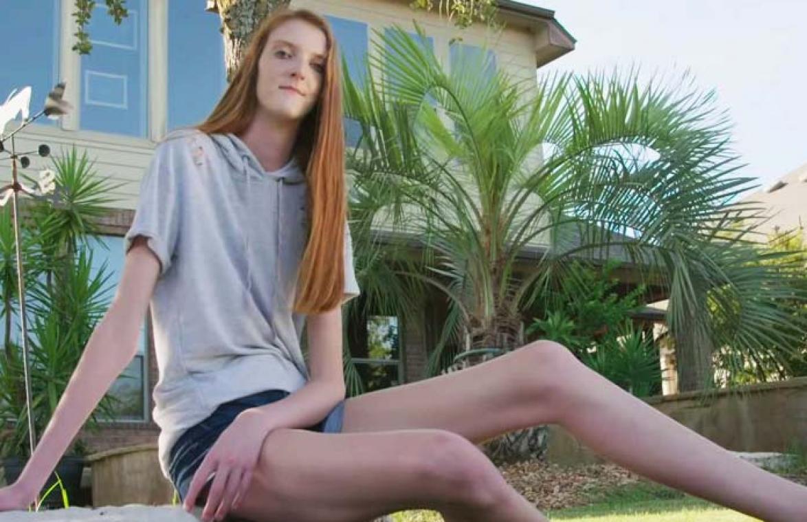 VIDEO. Dit 16-jarige meisje heeft de langste benen ter wereld
