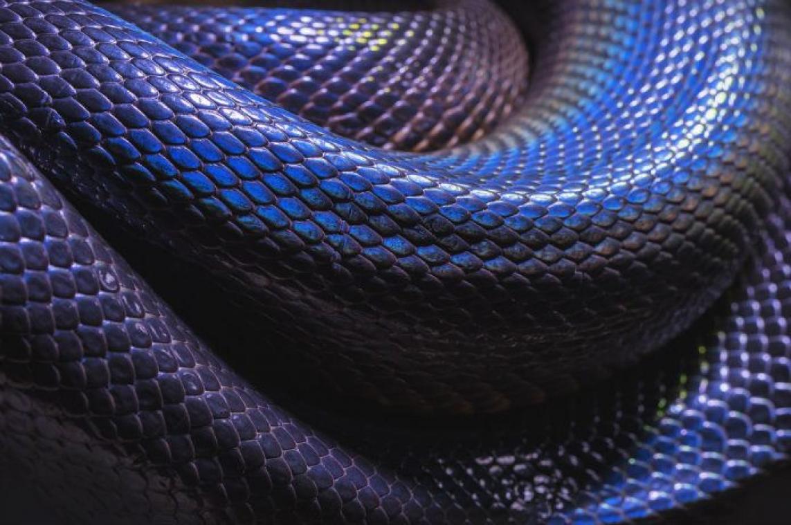 BIZAR. Jongen krijgt bijnaam 'menselijke slang' door huidaandoening