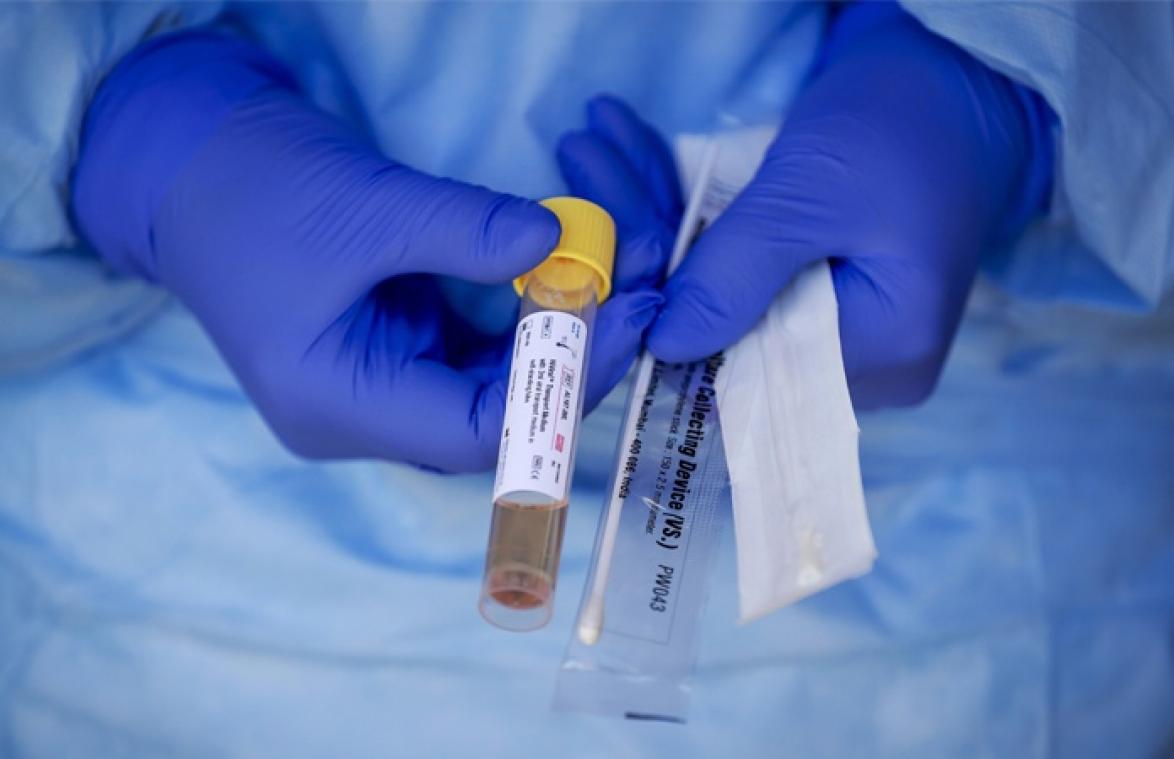 Belgische sneltest voor coronavirus goedgekeurd en klaar voor gebruik