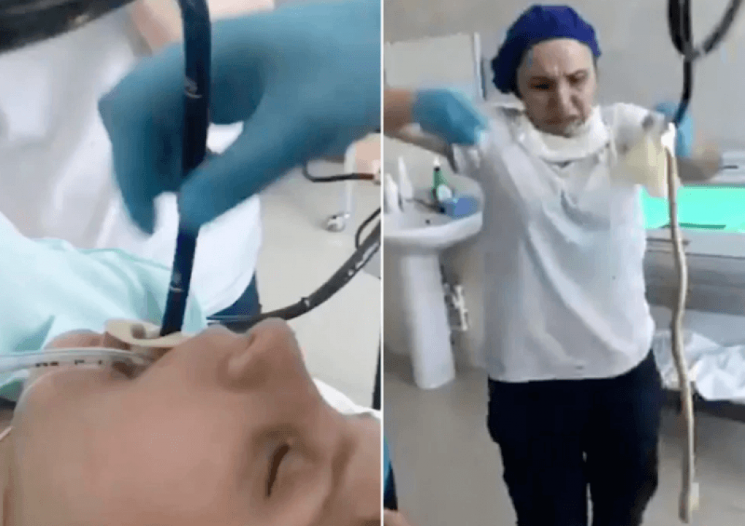 WTF. Is deze bizarre video waarin dokters een slang uit de keel van een vrouw halen echt?