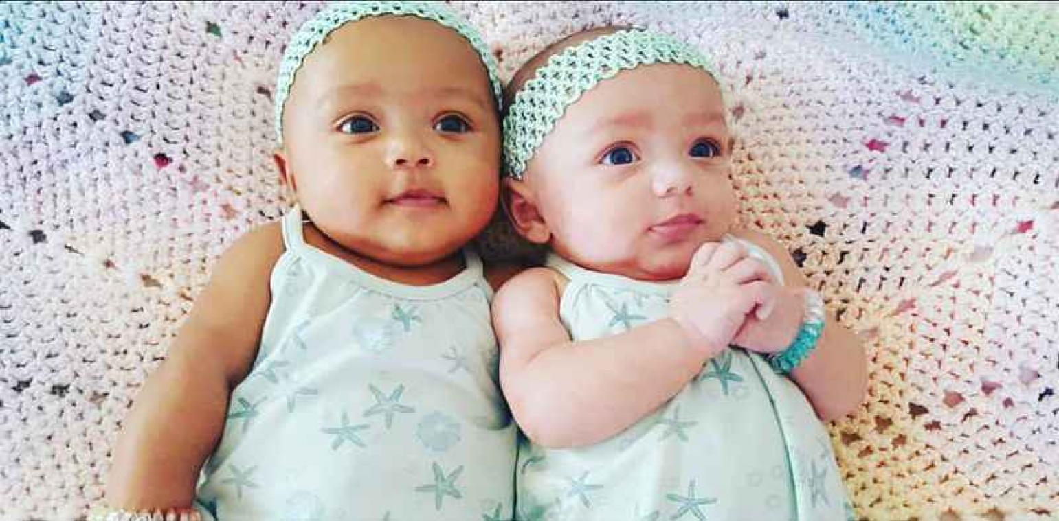 Tweelingzusjes zijn geboren met verschillende huidskleur