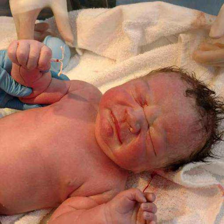 Baby wordt geboren met spiraal van zijn moeder in de hand