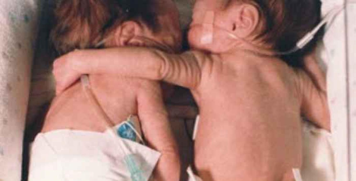 Tweelingzus redt na de geboorte het leven van haar zus in couveuse. Hoe vergaat het hen 18 jaar later?