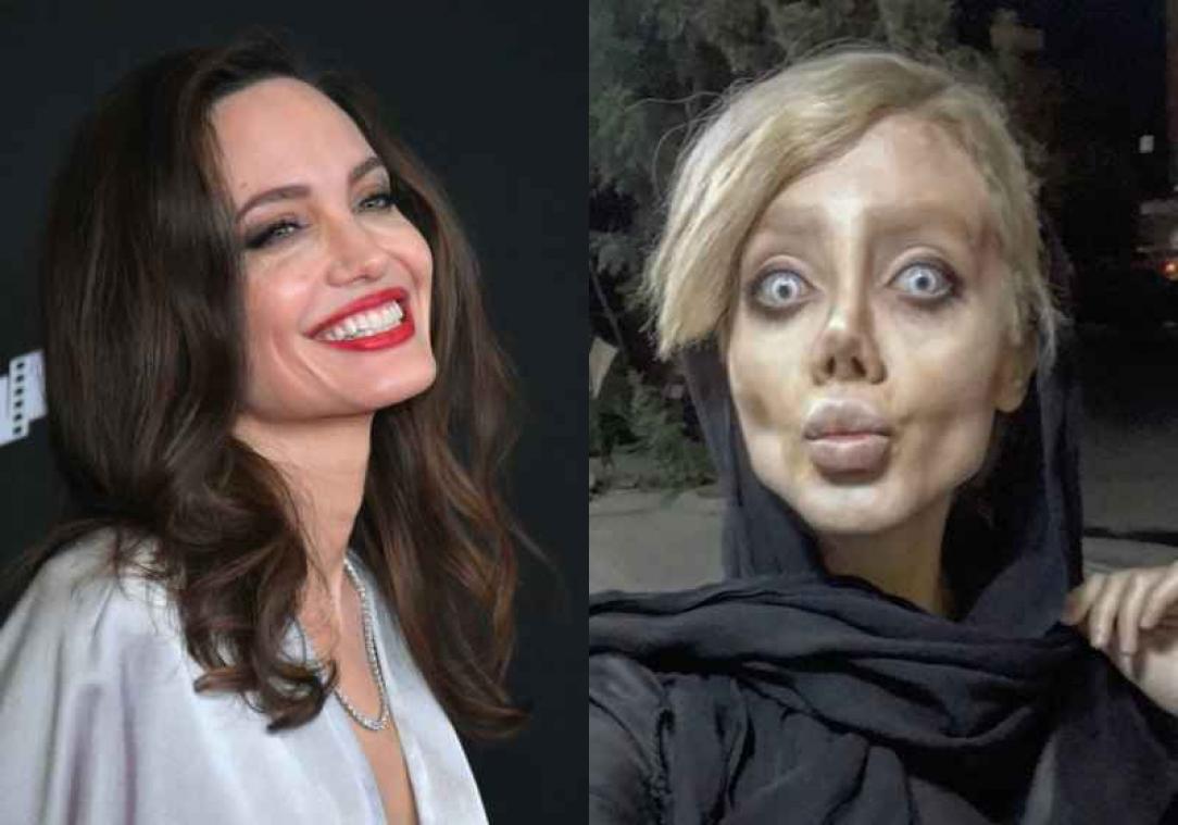 Sahar onderging vijftig operaties om op Angelina Jolie te lijken. Oordeel zelf over het resultaat...