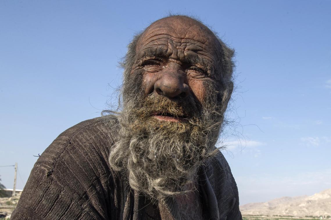 BIZAR. Hoogbejaarde Iraniër die zich sinds de jaren 50 niet meer gewassen had, overleden